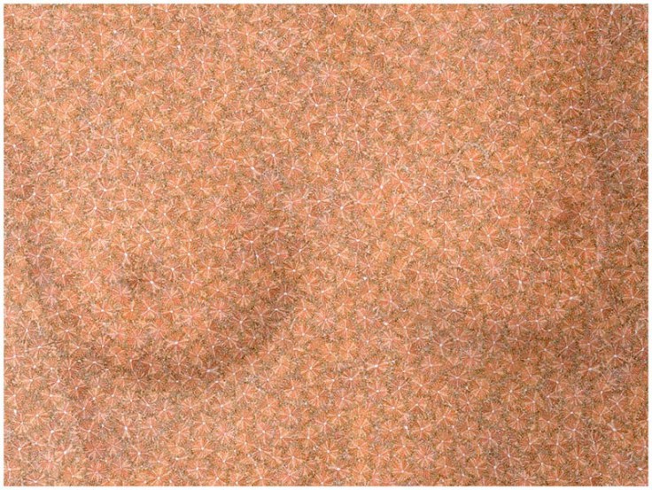 Breast-augmentations