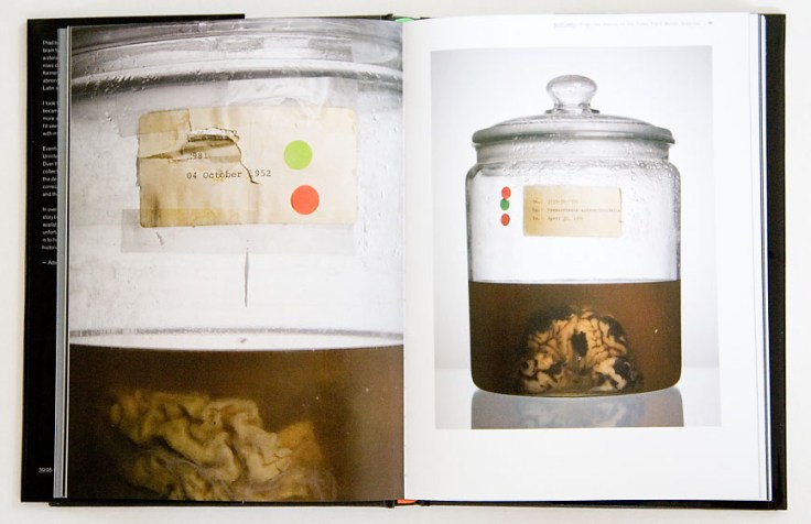 Adam_Voorhes-Malformed-Forgotten Brians_of_the_Texas_Mental_Hospital_2