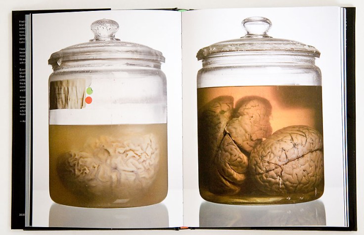 Adam_Voorhes-Malformed-Forgotten Brians_of_the_Texas_Mental_Hospital_4