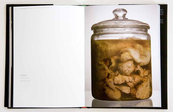 Adam_Voorhes-Malformed-Forgotten Brians_of_the_Texas_Mental_Hospital_7